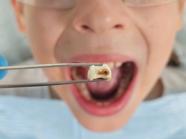 Best Emergency Denture Repair in Altamont, KS