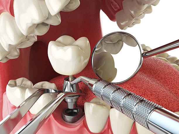 Reliable KS Emergency Dental Service Solutions